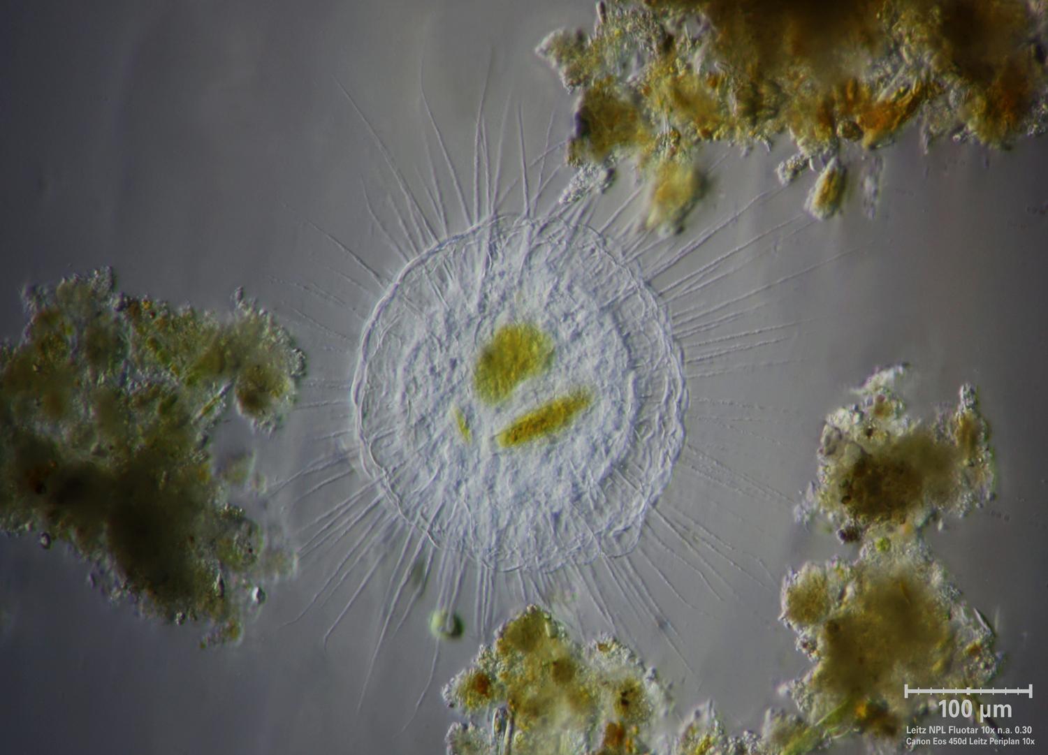Actinosphaerium
